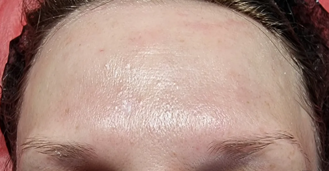 before-after