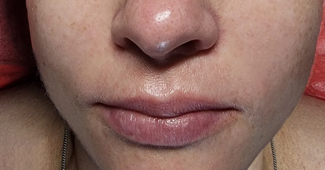 before-after