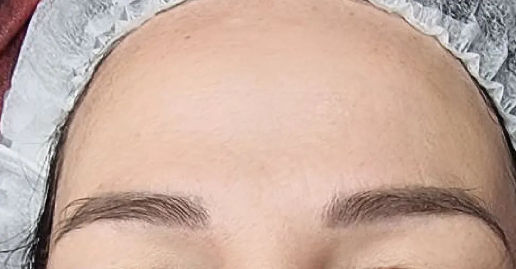 before-after