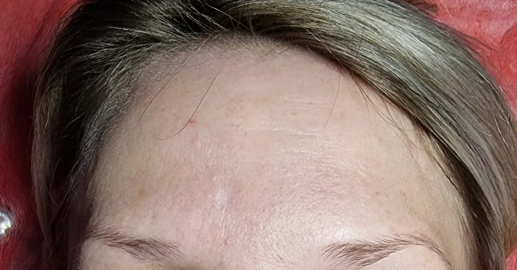 before-after
