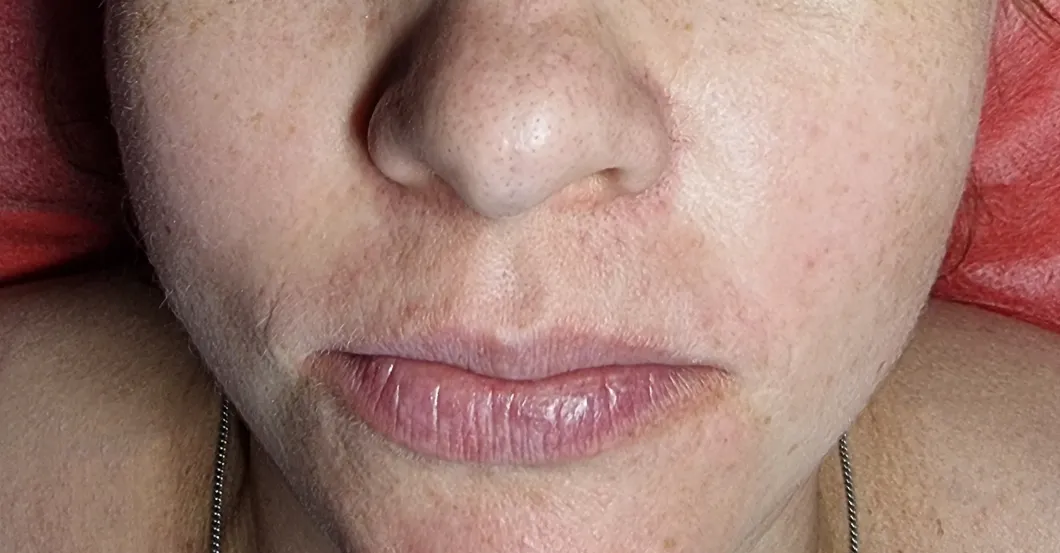 before-after