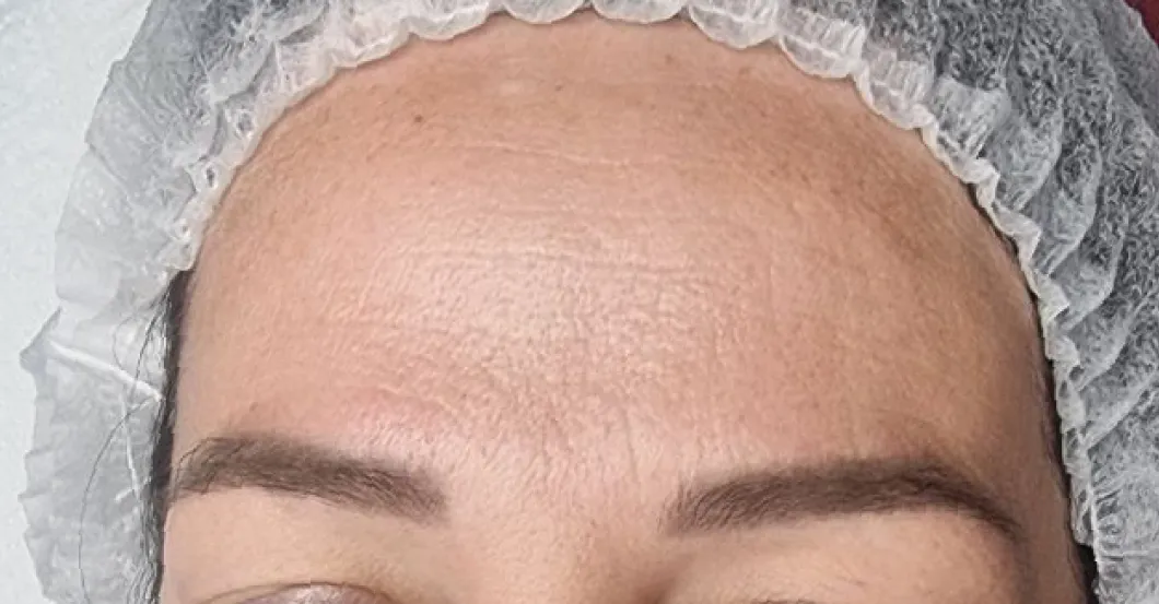 before-after