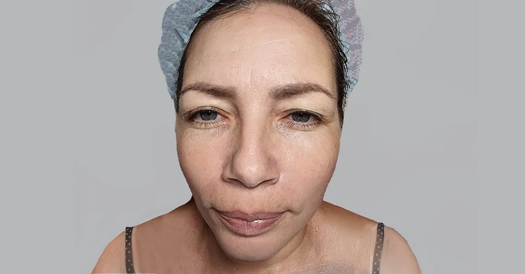 before-after