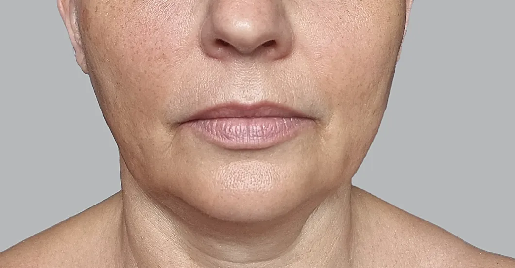 before-after