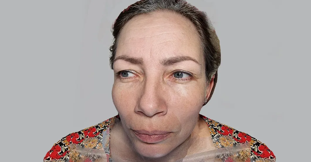 before-after
