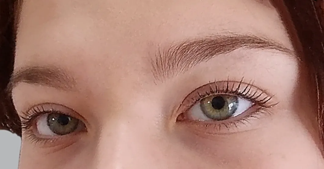 before-after