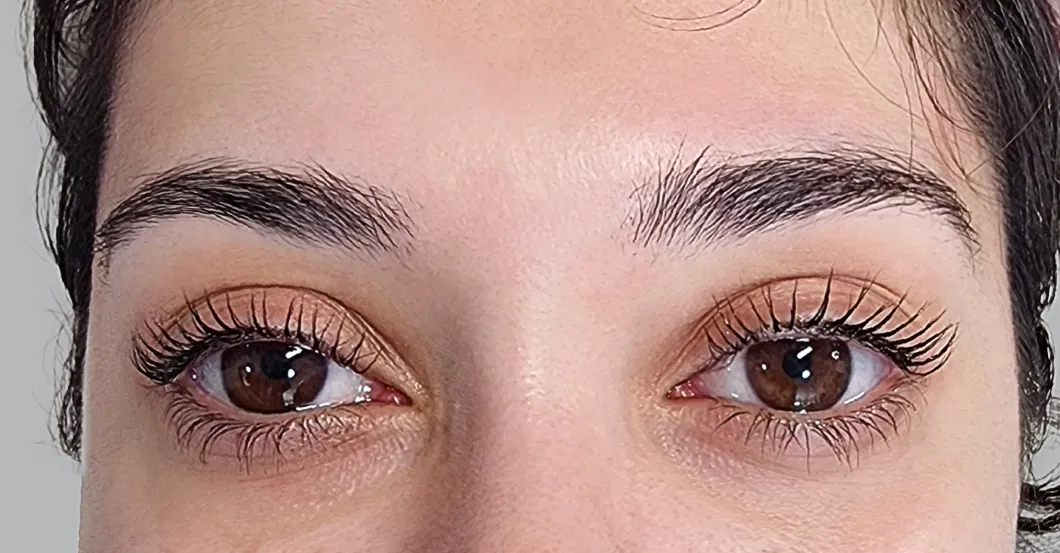 before-after