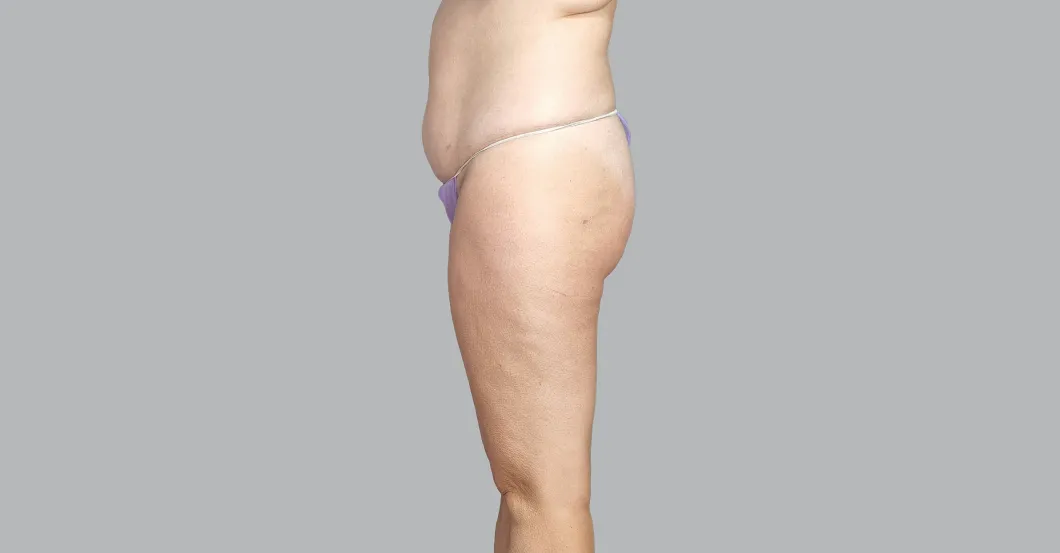 before-after