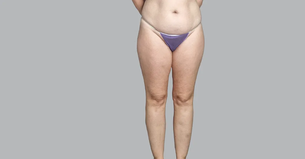 before-after