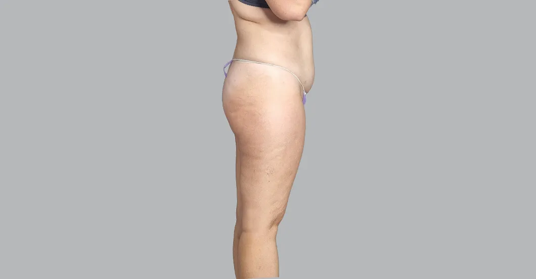before-after