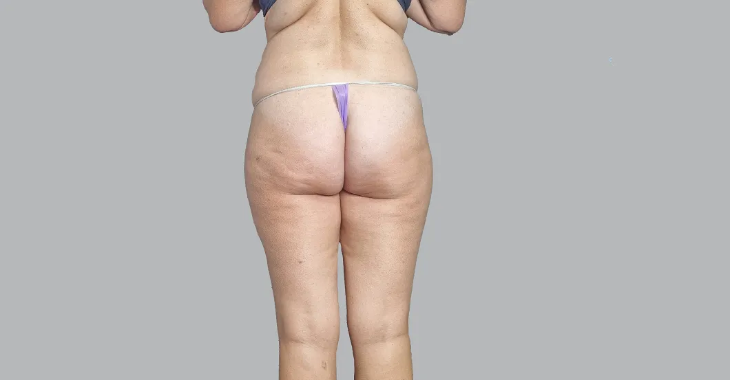 before-after