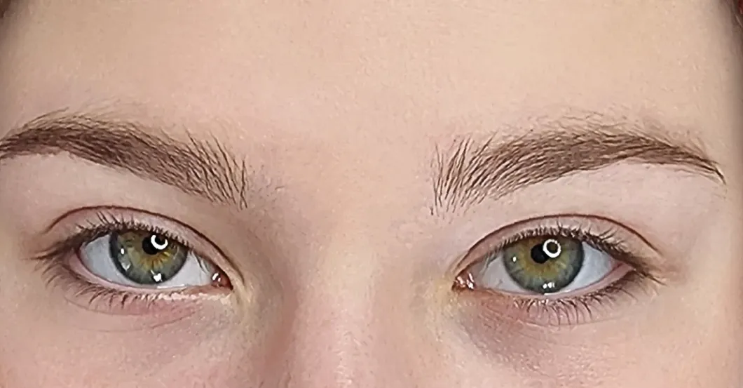 before-after