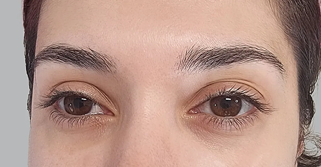 before-after