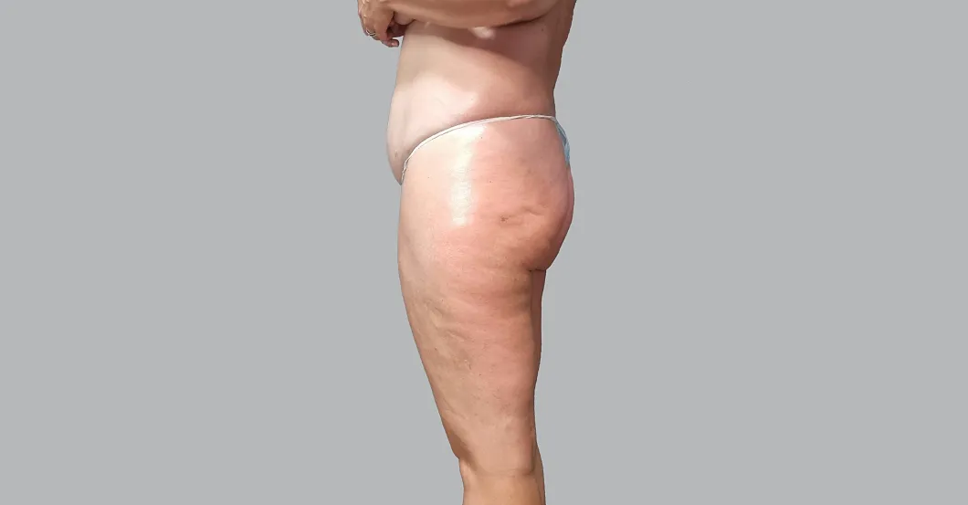 before-after