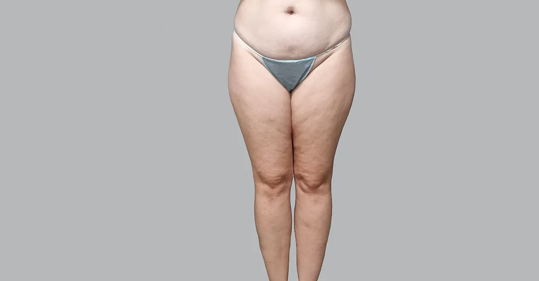 before-after