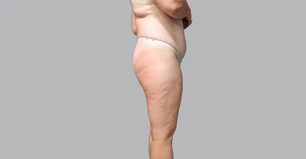 before-after