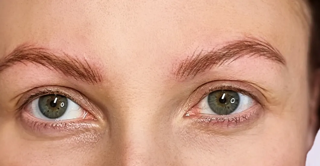 before-after