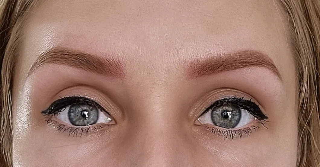before-after