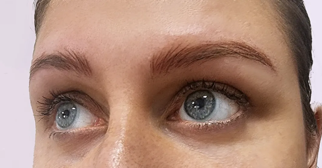before-after