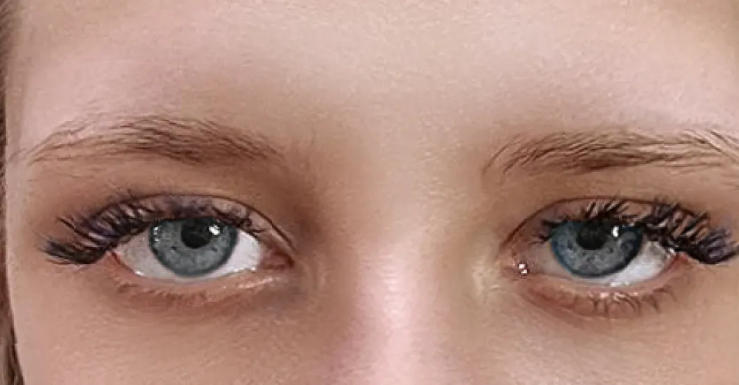 before-after