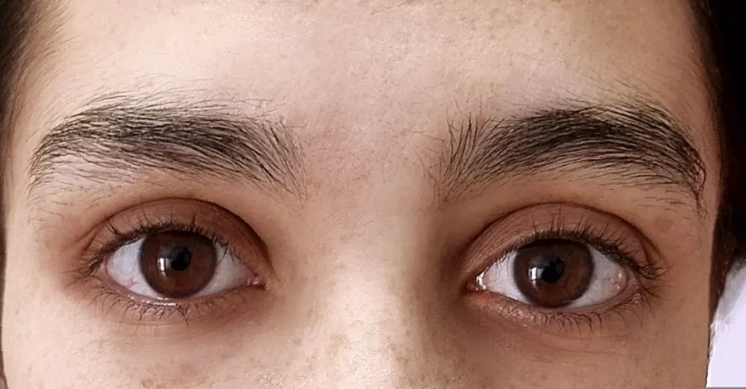before-after