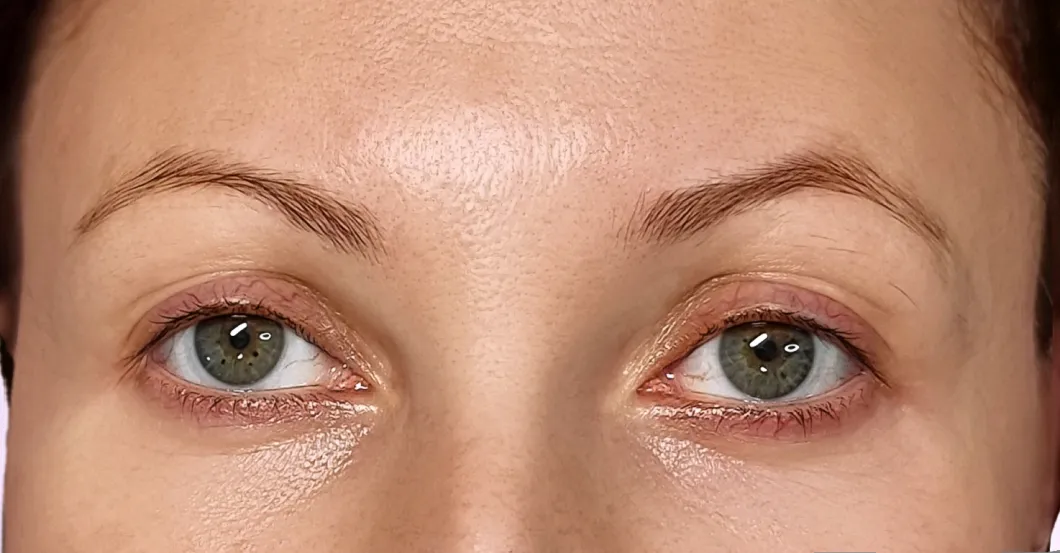 before-after