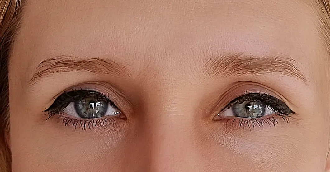 before-after