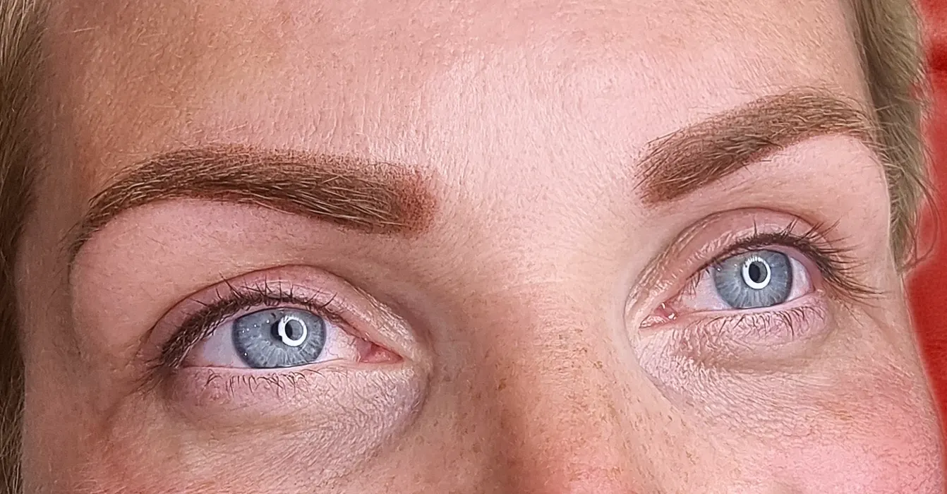 before-after
