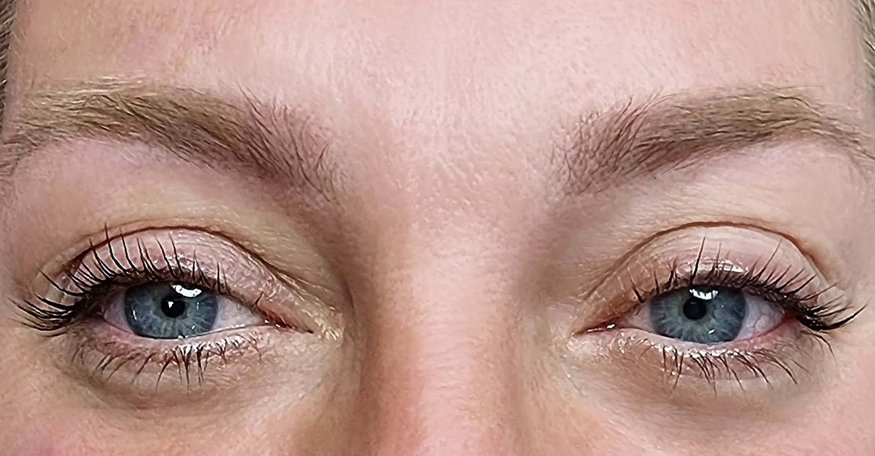 before-after