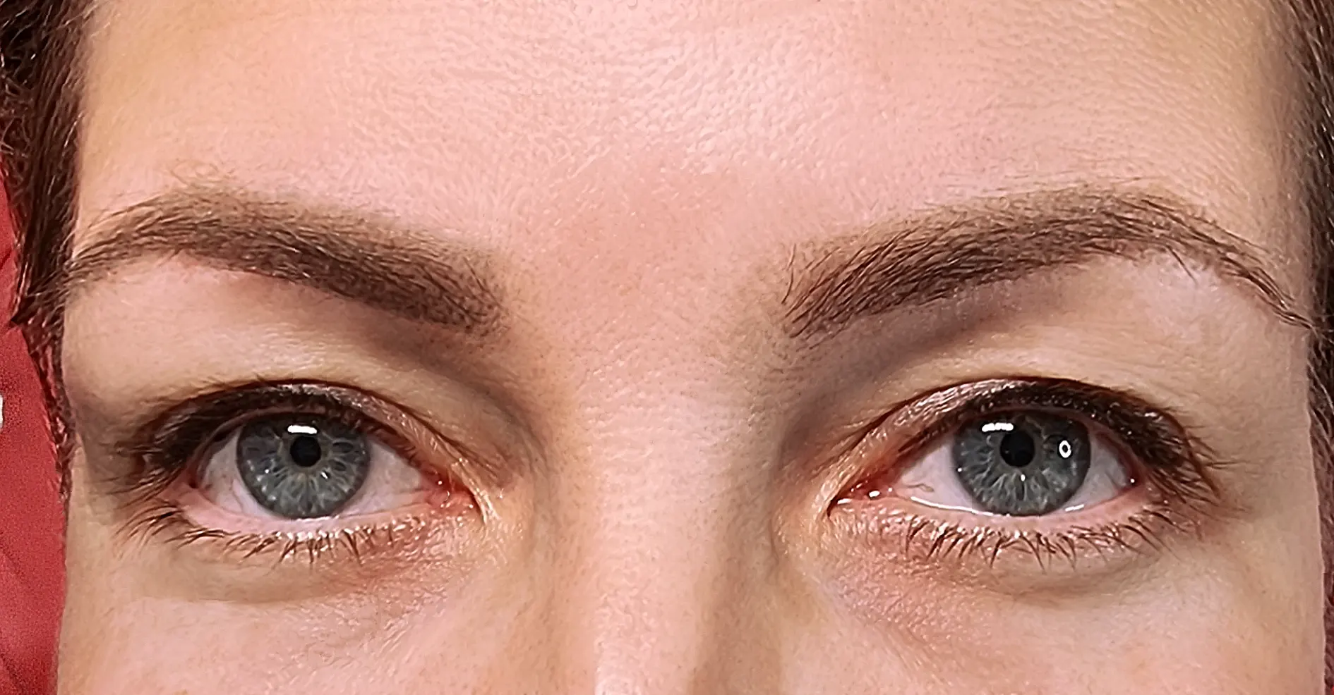 before-after