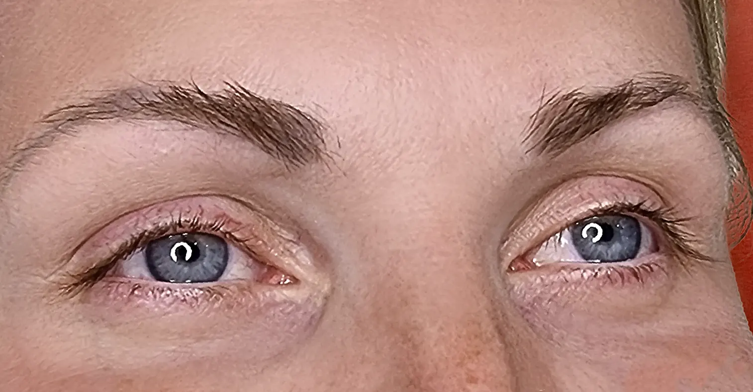 before-after