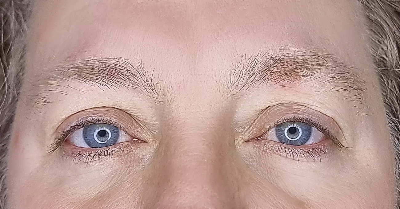 before-after