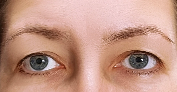 before-after