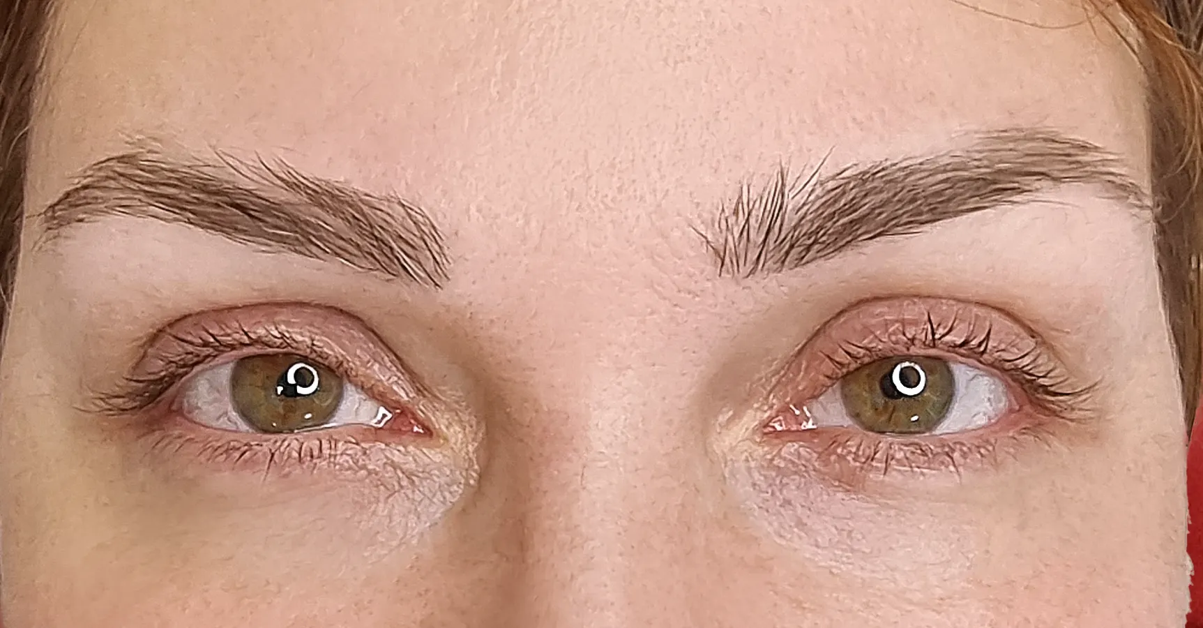 before-after